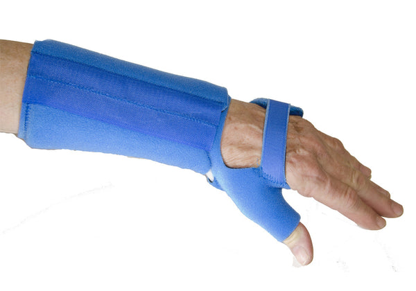 Ulnar Sided Wrist Pain: Comparison of 4 Splints
