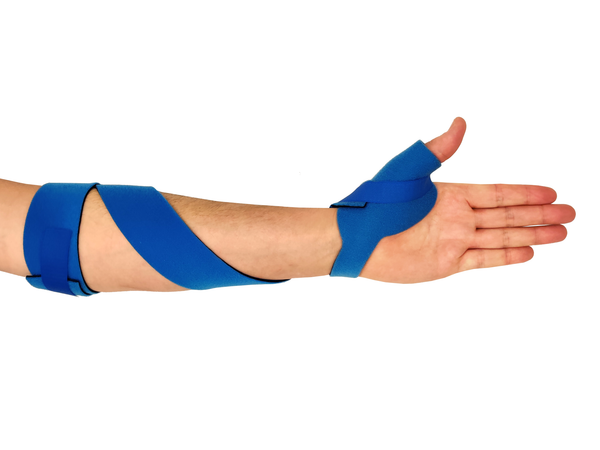 Allyson Splint Wrist-hand Splint Orthosis, Infant, Pediatric & Adult -  McKie Splints