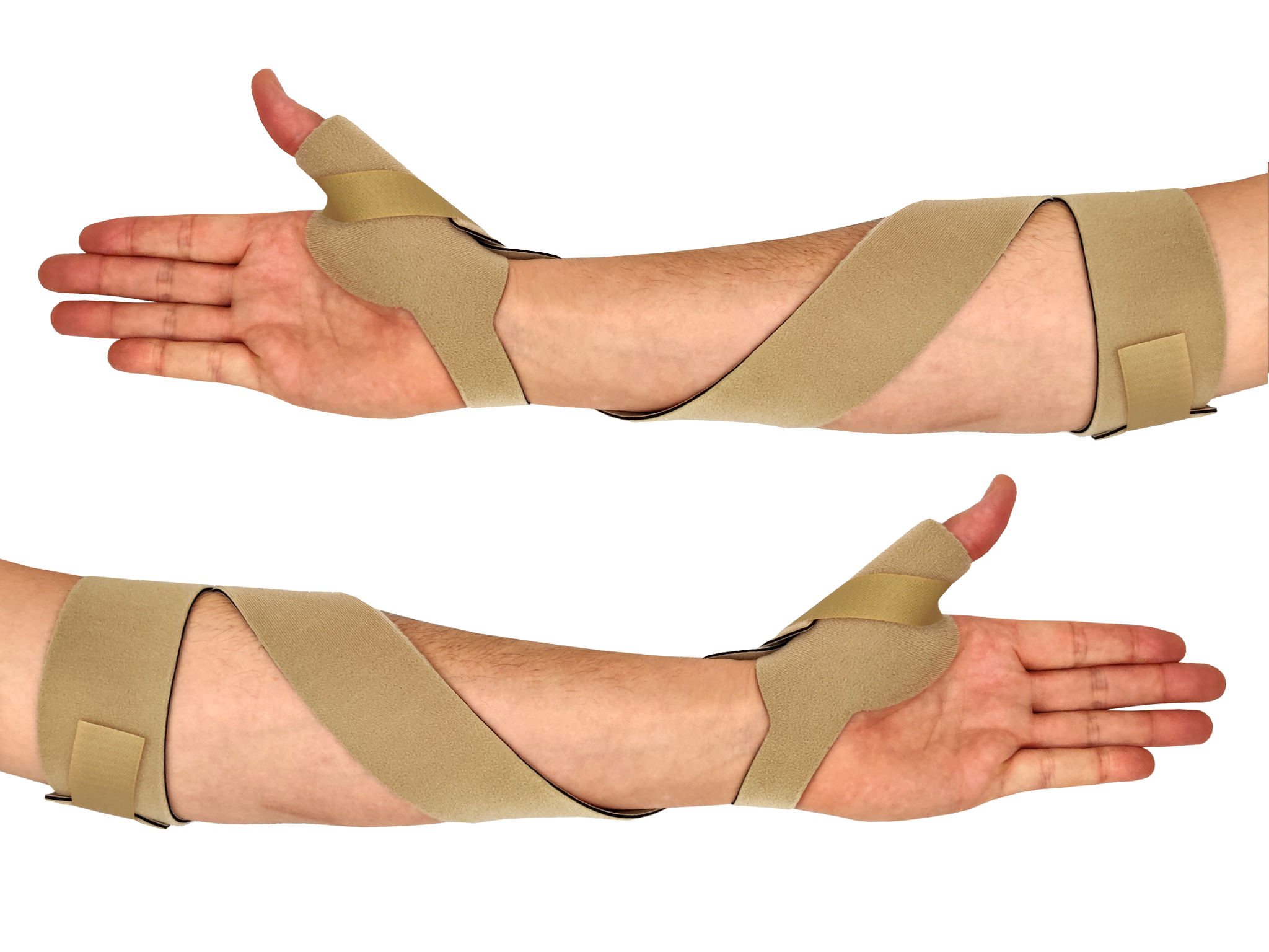 Biology Splints McKie Supination Strap & Thumb Splint Bundle (Adult Sizes) - McKie Splints