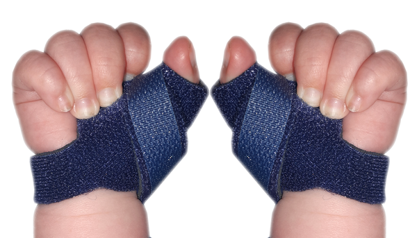 Infant Neonatal Thumb Splint for Cerebral Palsy, Stroke, M.S, Injury ...