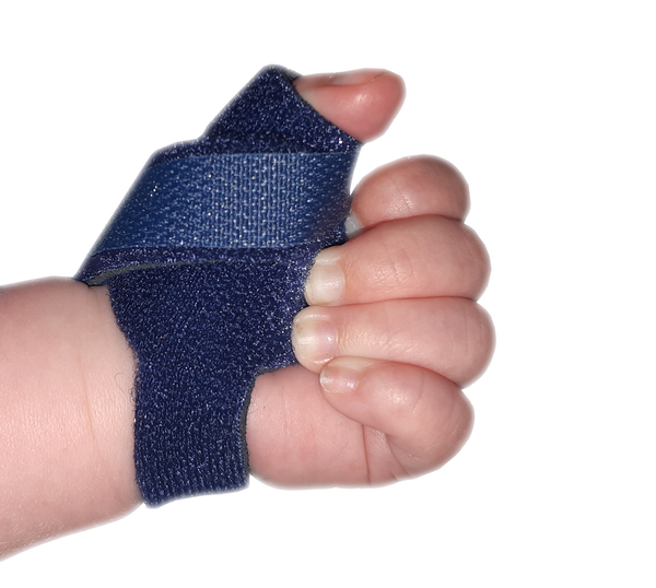 Infant Neonatal Thumb Splint for Cerebral Palsy, Stroke, M.S, Injury ...