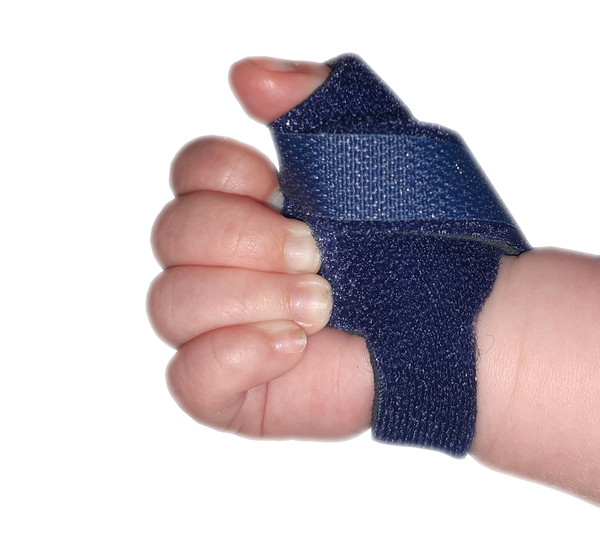 Infant Neonatal Thumb Splint for Cerebral Palsy, Stroke, M.S, Injury ...