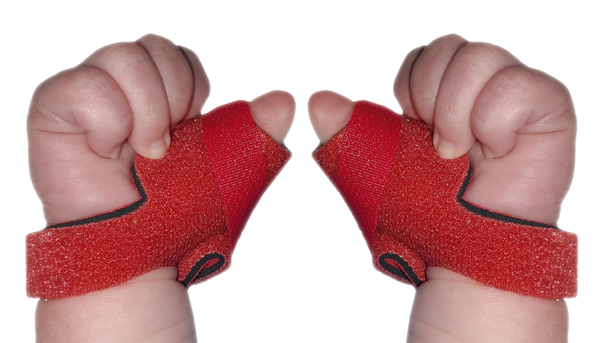 Infant Neonatal Thumb Splint for Cerebral Palsy, Stroke, M.S, Injury ...
