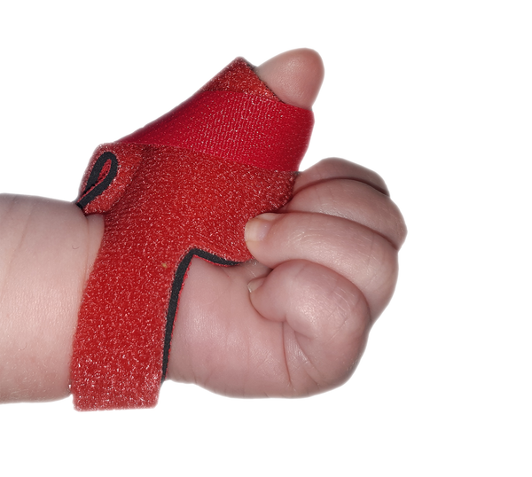 Infant Neonatal Thumb Splint for Cerebral Palsy, Stroke, M.S, Injury ...
