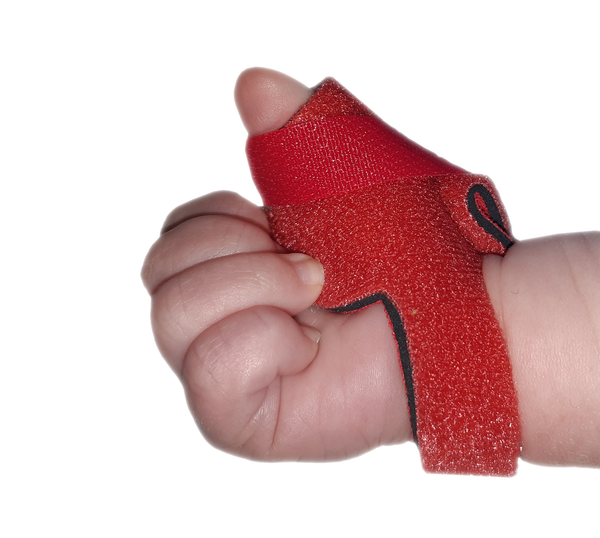 Infant Neonatal Thumb Splint for Cerebral Palsy, Stroke, M.S, Injury ...