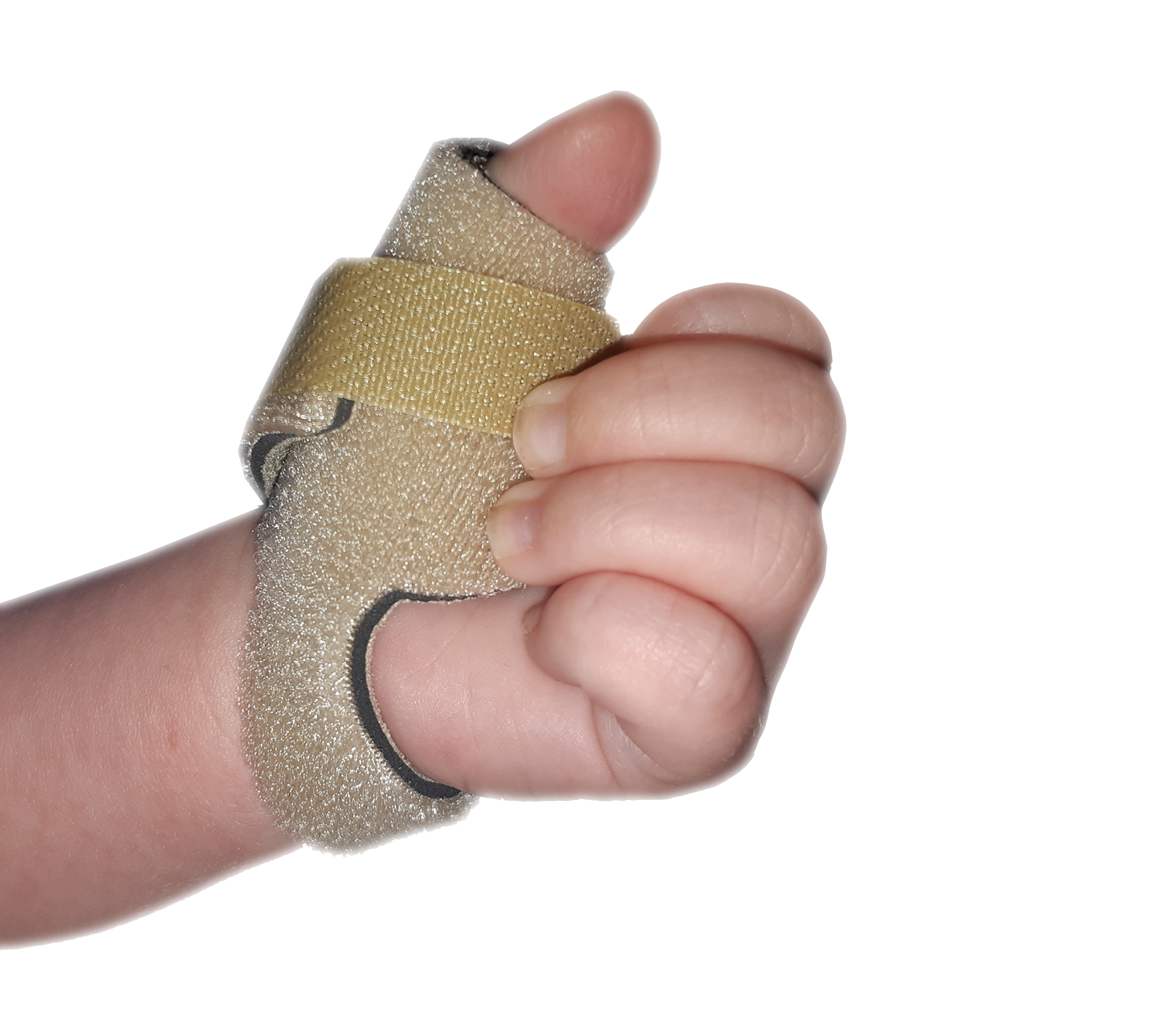Infant Neonatal Thumb Splint for Cerebral Palsy, Stroke, M.S, Injury ...