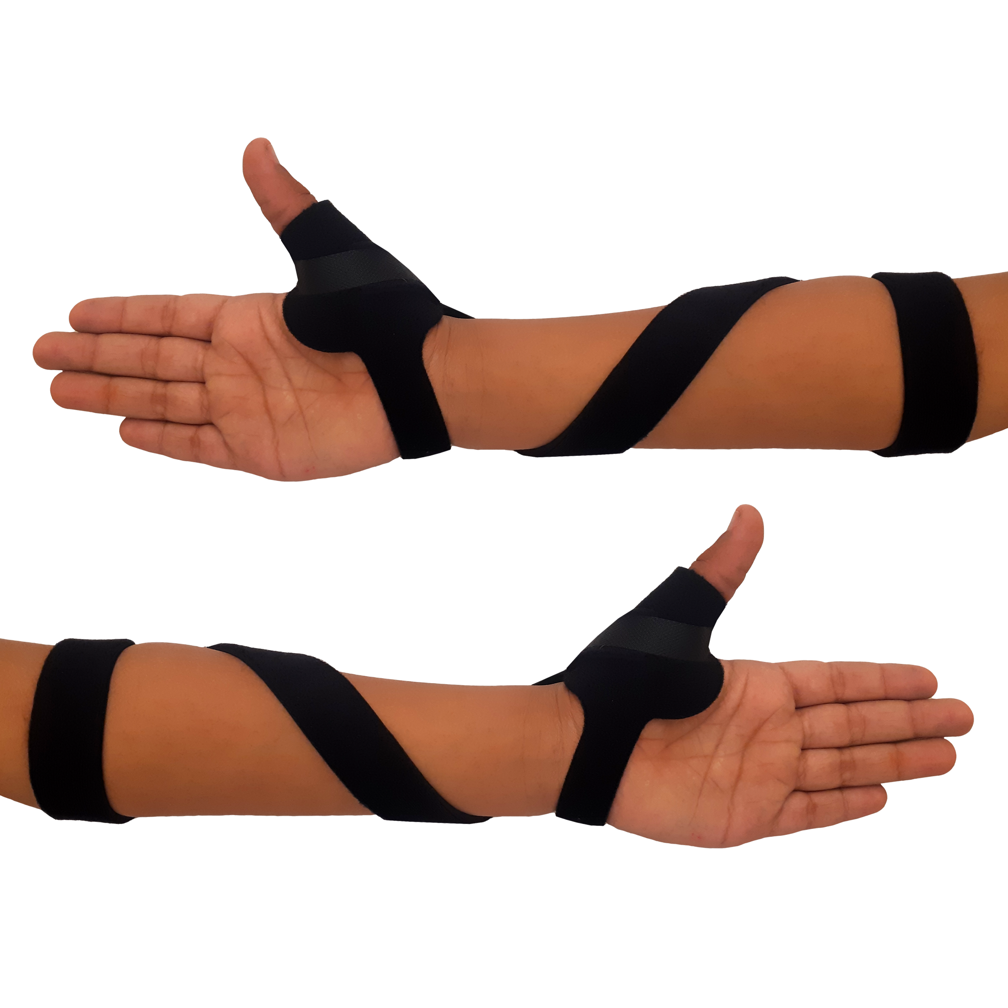 McKie Supination Strap & Thumb Splint Bundle (Pediatric Sizes) - McKie ...